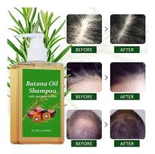 🍂SHAMPOO BATANA 🍂