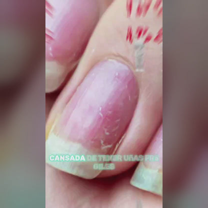 💅ENDURECEDOR DE UÑAS 4K POTENTE⭐⭐⭐ CRECIMIENTO🔝 & HONGOS💫